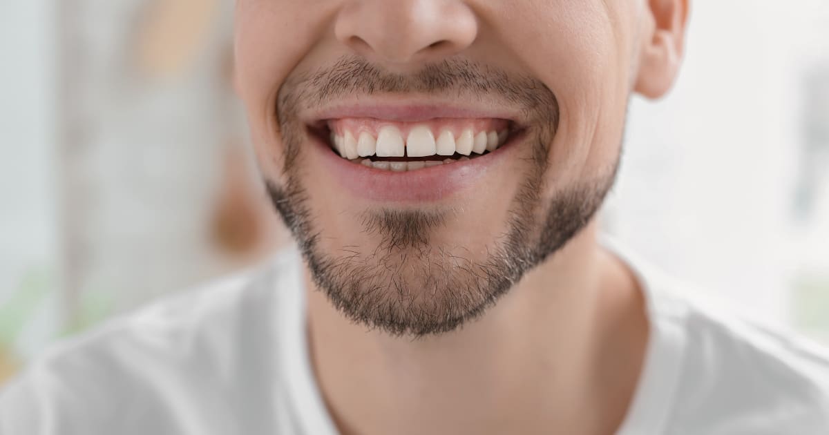 Mann mit schönen Zähnen nach Implantat-Therapie