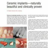 Ceramic implants—naturally beautiful and clinically proven